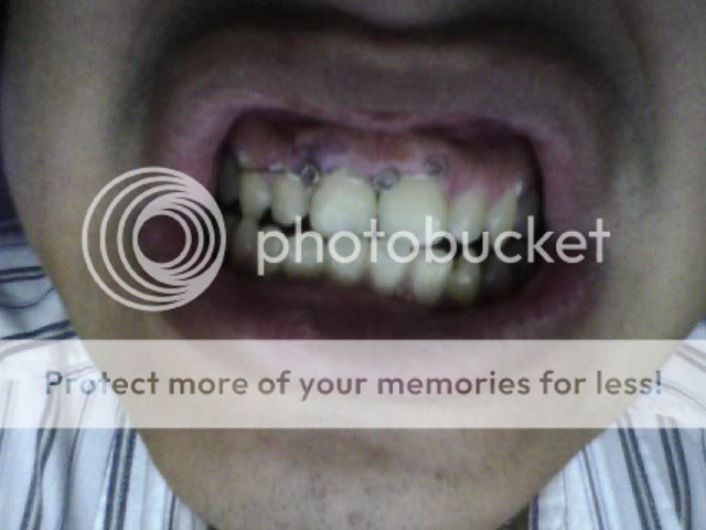 HUm nay, đánh nhau ... - 2